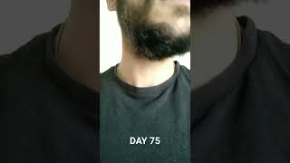 Patchy beard 75 days growth 32 yo 2024 [upl. by Anoid]