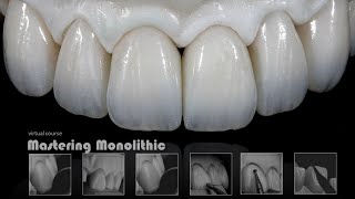 Mastering Monolithic Zirconia In Arabic [upl. by Dougy]