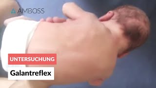 Galantreflex  Frühkindliche Reflexe  AMBOSS Video [upl. by Dirrej791]