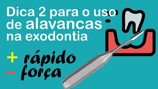 Dica 2 para o uso de alavancas na exodontia  Odontologia  Dra Bianca Rosa [upl. by Uyr]