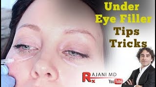 Watch Under Eye FillerTips and Tricks Portland Oregon Restylane Juvederm and PRF Injections [upl. by Sally]