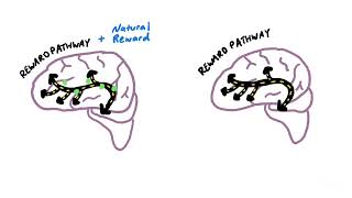 How an Addicted Brain Works [upl. by Oos]