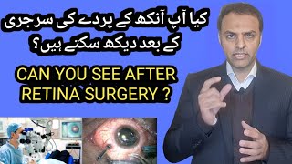 Retinal Detachment  Can You See After Surgery  Treatment retinaldetachment youtubevideos [upl. by Davidoff514]