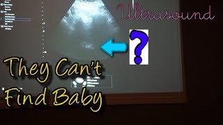 8 Weeks Pregnant Ultrasound  Cant Find Baby  Scared [upl. by Sibylla]