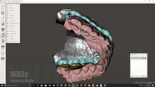 Planmeca Romexis Occlusal Guard [upl. by Sayres]