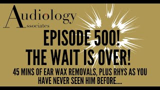 45 MINS OF EAR WAX REMOVALS WITH A TWIST  EP500 [upl. by Brawley]