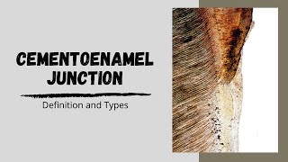 Cementoenamel Junction and its types [upl. by Miki817]