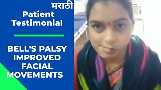 Bells Palsy Patient Recovery Feedback Post Physiotherapy Treatment  leadphysiocom [upl. by Emiline]