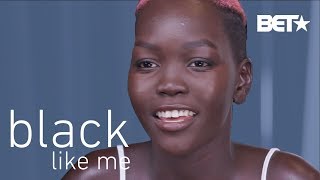 This Viral Model Sensation Wanted to Bleach Her Skin to Fit In  Black Like Me [upl. by Greenwood]