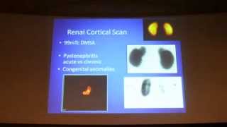 RENAL CORTICAL SCINTIGRAPHY by DRKAVITHA Prof and HOD  Nuclear medicine KREST 2015 22 [upl. by Irehj]