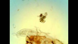 Coleps and paramecium [upl. by Inanak]