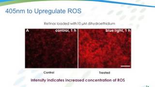 Lunula Laser Science Video [upl. by Simsar489]