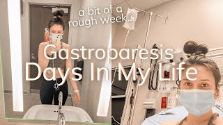 a rough week gastroparesis and pots  gastroparesis days in my life [upl. by Yrac]