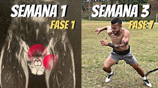 Como curei minha pubalgia EM 3 SEMANAS Como tratar e exercícios [upl. by Oyr]