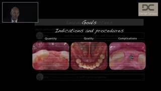 Soft Tissue Management in Implant Dentistry [upl. by Rudman502]