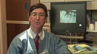 Tooth Abscess  How to Treat an Abscess With Home Remedies [upl. by Acker]