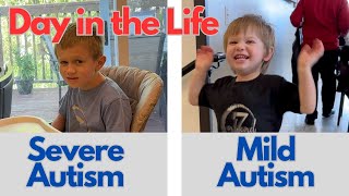 A Day in the Life of Mild Autism and Severe Autism [upl. by Ahseela]