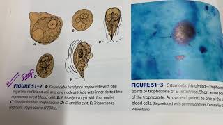 Intestinal and UrogenitalProtozoaParasitology [upl. by Rexfourd]