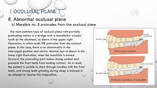 Occlusal plane [upl. by Aman848]