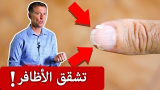 نقص هذا العنصر يسبب تشقق وتقصف الاظافر [upl. by Uyekawa]