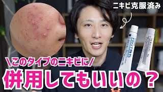 【重要】ベピオとダラシンを併用する時の正しい塗り方を薬剤師が解説します【ニキビ治療】 [upl. by Ixela]