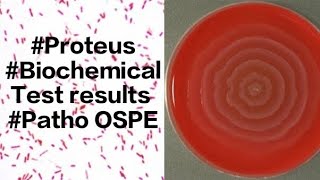 Proteus Tests results TSI Motility Indole Citrate [upl. by Fawn]