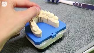 Vom Zahnarztbesuch bis zur fertigen Krone Ein Blick hinter die Kulissen bei Flemming Dental [upl. by Starkey]