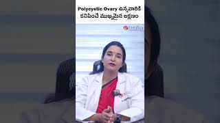 What is Polycystic Ovary  Symptoms  Causes  Dr Sumina Reddy  PCOS  Treatment  Fertilica IVF [upl. by Donovan]