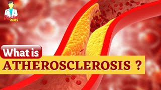 What is Atherosclerosis [upl. by Alleris]