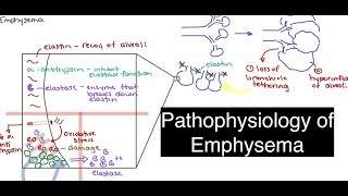 Emphysema Pathophysiology [upl. by Inatirb610]