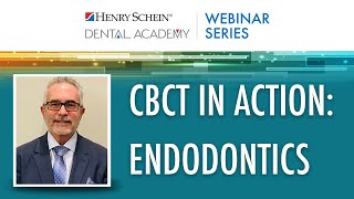 CBCT in Action Endodontic Diagnosis and Treatment Planning of Complex Cases [upl. by Eilraep]