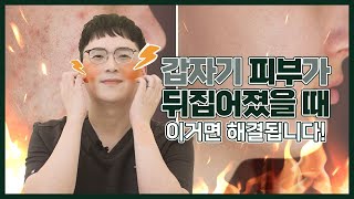 피부뒤집어졌을때 이렇게 조치하세요  환절기 피부 트러블 해결방법 [upl. by Nikal]