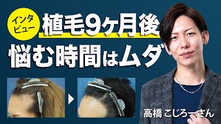 【インタビュー】自毛植毛から9ヶ月経過後の効果と変化「高橋こじろーさん」 [upl. by Nered]