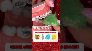 5 CRYSTAL CANDIES to AVOID with braces what to eat instead crunchy sounds shorts asmr braces [upl. by Kahle]