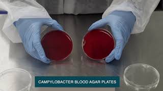 Unveiling Microbial Growth Revealing Microbial Growth on Various Agar Media [upl. by Eelsnia55]