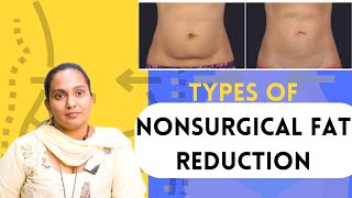 Types Of Nonsurgical Fat Reduction  Injection Lipolysis  Laser Lipolysis  Cryolipolysis [upl. by Nandor914]