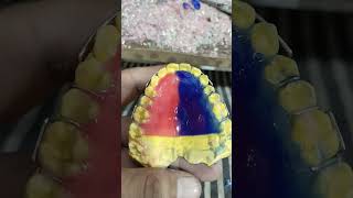 Removable Orthodontic Retainer Appliance Making By Haider 😁😁😁retainer [upl. by Harahs621]