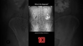 Abdominal Xray Question 9 [upl. by Drofdeb]