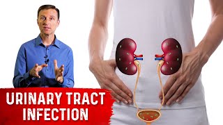 Top Remedies for a UTI Urinary Tract Infection Updated [upl. by Osei745]