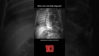 Abdominal Xray Question 15 [upl. by Thain736]