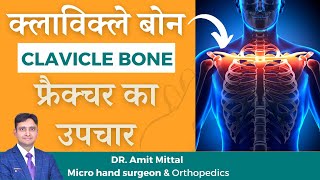 clavicle bone fracture treatment in Hindi  broken collar bone  clavicle bone  clavicle fracture [upl. by Leahicm]