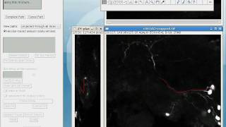 Simple Neurite Tracer  basic tracing [upl. by Hurlow]