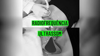 Radiofrequência ou ultrassom qual é o melhor para tratar gordura [upl. by Oznecniv]