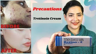 Retino A 0025cream  Before And After Tretinoin Cream PRECAUTIONS  My experience with Tretinoin [upl. by Ready447]