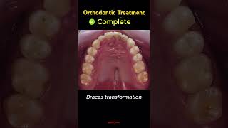 trending dentist dentalclinic orthodontist dental smile braces dentistry shorts yt bds [upl. by Dympha]