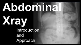 Abdominal Xray Introduction and Approach [upl. by Ttenaj]