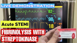 Fibrinolysis with streptokinase in acute STEMI  fibrinolisis pada STEMI serangan jantung berat [upl. by Canon]