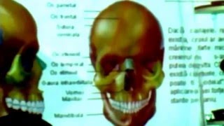 Anatomie  sistemul ososcurs [upl. by Serrano]