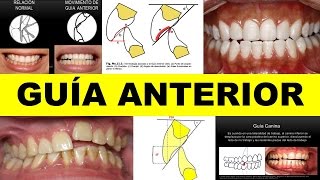 quotGUÍA ANTERIOR 1quot por el Dr Hugo Pérez [upl. by Laith]