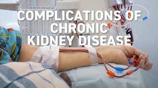 Complications of Chronic Kidney Disease [upl. by Muhan]